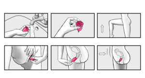 Hur sätter man in en menskopp
