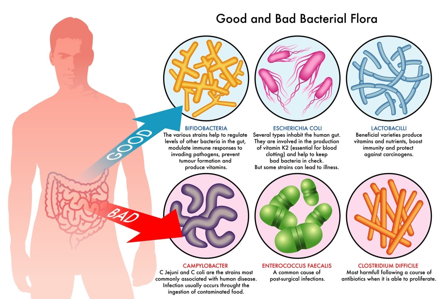 Probiotika bra och dåliga bakterier