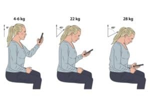 Mobilnacke hälsorisker med gamnacke