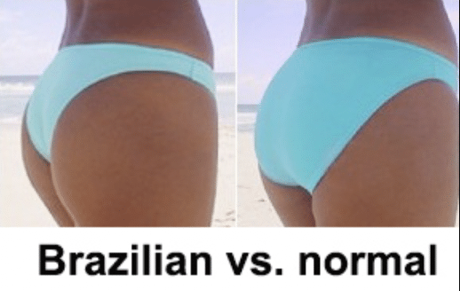 Skillnad brazilian bikinitrosa och vanlig